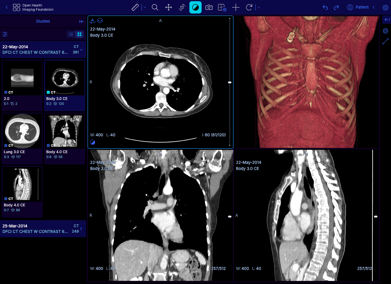 OHIF Viewer